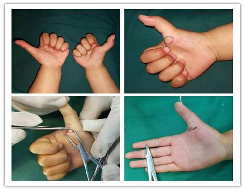 1dbc0003924c492298a2